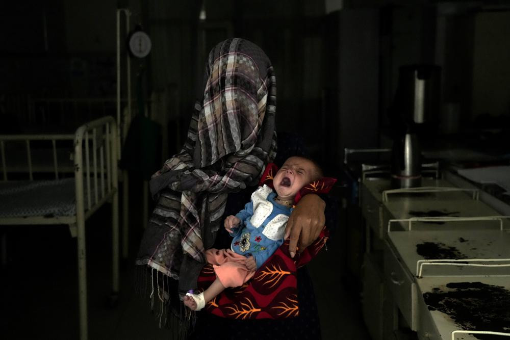 Nazia 30, who has lost four children due to severe malnutrition, holds her malnourished baby in a hospital in Parwan province north of Kabul, Afghanistan, Thursday, May 19, 2022.