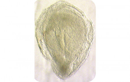 This image from Oxford University shows a human embryo 16-19 days after fertilization.