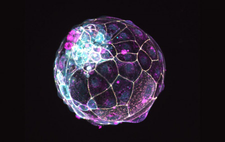 This image, provided by the Institute of Molecular Biology of the Austrian Academy of Sciences, shows a human “blastoid” created in a lab.
