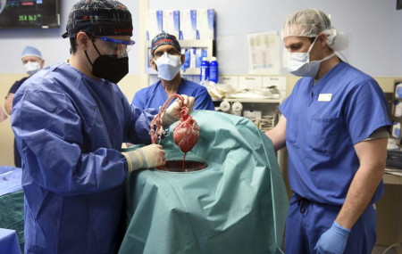 In this photo provided by the University of Maryland School of Medicine, members of the surgical team show the pig heart for transplant into patient David Bennett in Baltimore on Friday, Jan. 7, 2022.