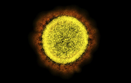 This 2020 electron microscope image made available by the National Institute of Allergy and Infectious Diseases shows a Novel Coronavirus SARS-CoV-2 particle isolated from a patient, in a laboratory in Fort Detrick, Maryland.