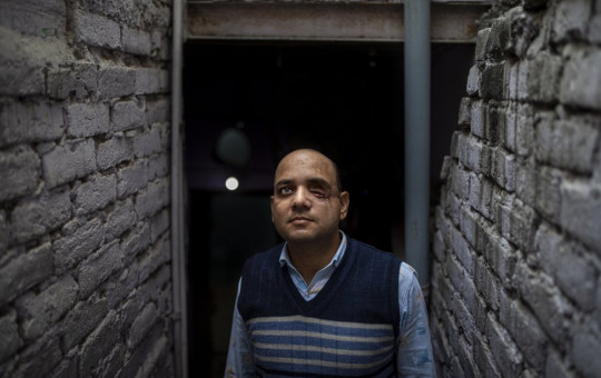 Muhammad Nasir Khan, who was shot by a Hindu mob during the February 2020 communal riots, poses for a photograph inside his home in North Ghonda, one of the worst riot affected neighborhood, in New Delhi, India, Friday, Feb. 19, 2021.