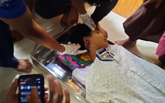 In this March 30, 2021 photo provided by Dawei Watch news outlet, a relative points to an open wound in the neck of 17-year old Kyaw Min Latt in Dawei, Myanmar.