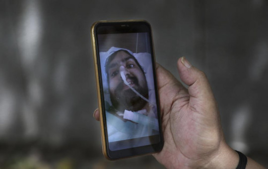 Anil Sharma shows a photograph of his son Saurav who is being treated for COVID-19 at a private hospital in New Delhi, India, Thursday, July 1, 2021.