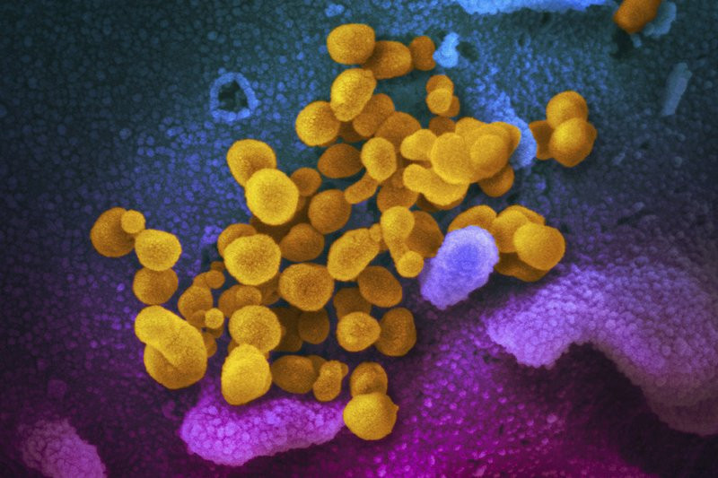 This undated electron microscope image made available by the U.S. National Institutes of Health in February 2020 shows the Novel Coronavirus SARS-CoV-2, yellow, emerging from the surface of c
