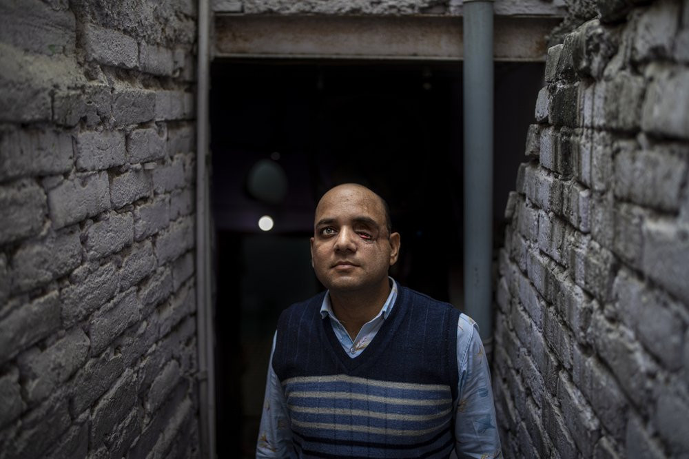 Muhammad Nasir Khan, who was shot by a Hindu mob during the February 2020 communal riots, poses for a photograph inside his home in North Ghonda, one of the worst riot affected neighborhood, 