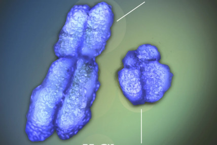This image provided by National Institutes of Health (NIH) shows the X and Y chromosomes.  AP/RSS Photo