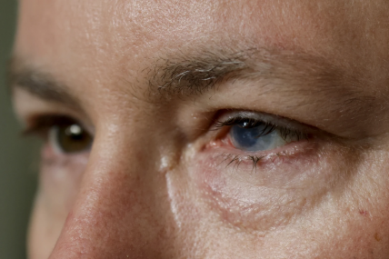 Phil Durst's eyes