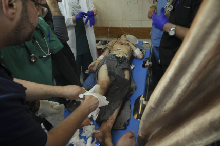 A palestinian child wounded in Israeli attack on Saturday. AP/RSS Photo
