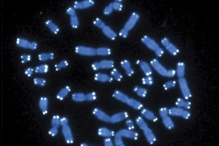 FILE - This microscope image shows the 46 human chromosomes, blue, with telomeres appearing as white pinpoints. Scientists have found the genetic cause of a neurodevelopmental disorder that they estimate affects as many as one in 20,000 young people. AP/RSS Photo