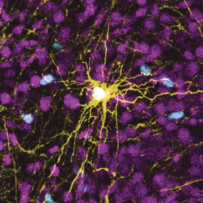 This microscope image provided by Pasca Lab/Stanford Medicine shows a human astrocyte cell, center in yellow, and human glial cells (scattered in blue) inside the brain of a rat. AP/RSS Photo