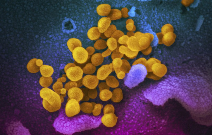 This undated electron microscope image made available by the U.S. National Institutes of Health in February 2020 shows the Novel Coronavirus SARS-CoV-2, yellow, emerging from the surface of c