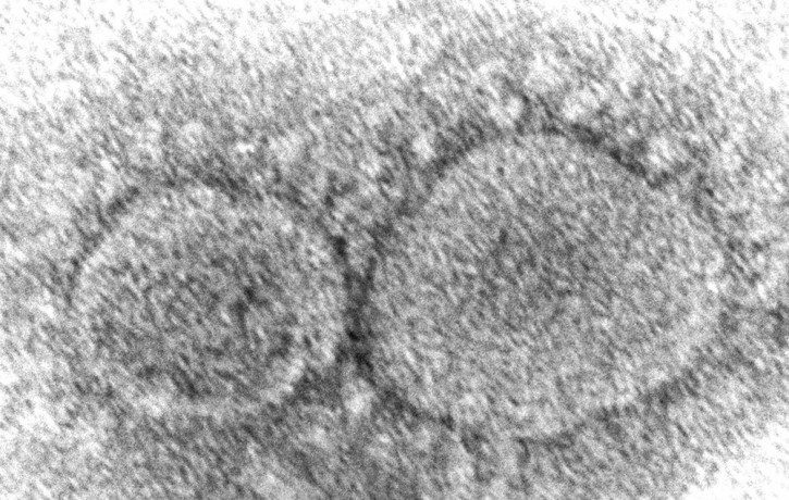 This 2020 electron microscope image made available by the Centers for Disease Control and Prevention shows SARS-CoV-2 virus particles which cause COVID-19.