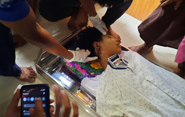 In this March 30, 2021 photo provided by Dawei Watch news outlet, a relative points to an open wound in the neck of 17-year old Kyaw Min Latt in Dawei, Myanmar.