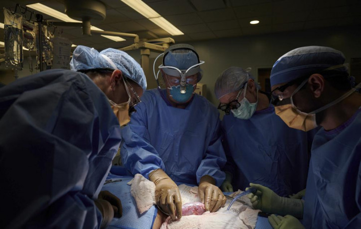 In this September 2021 photo provided by NYU Langone Health, a surgical team at the hospital in New York examines a pig kidney attached to the body of a deceased recipient for any signs of re