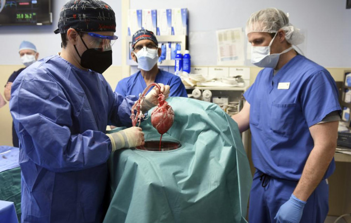 In this photo provided by the University of Maryland School of Medicine, members of the surgical team show the pig heart for transplant into patient David Bennett in Baltimore on Friday, Jan.