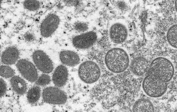 FILE - This 2003 electron microscope image made available by the Centers for Disease Control and Prevention shows mature, oval-shaped monkeypox virions, left, and spherical immature virions, 