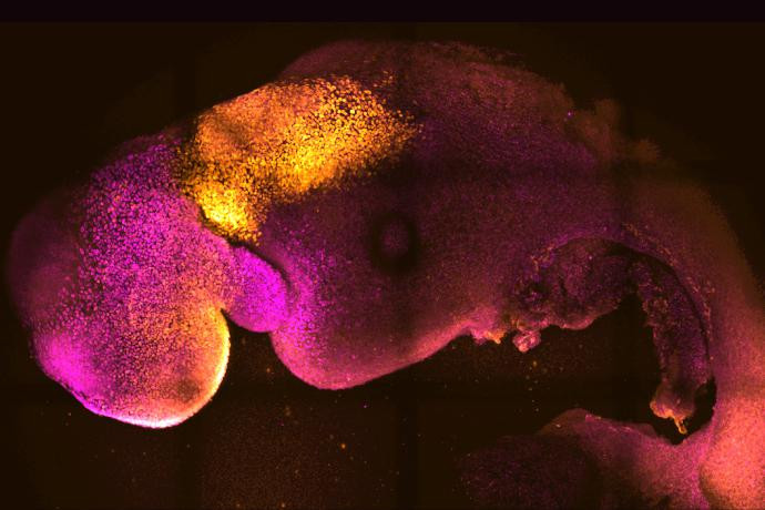 This microscope image provided by researchers Gianluca Amadei and Charlotte Handford in August 2022 shows a synthetic mouse embryo with colors added to show brain and heart formation.  AP/RSS Photo