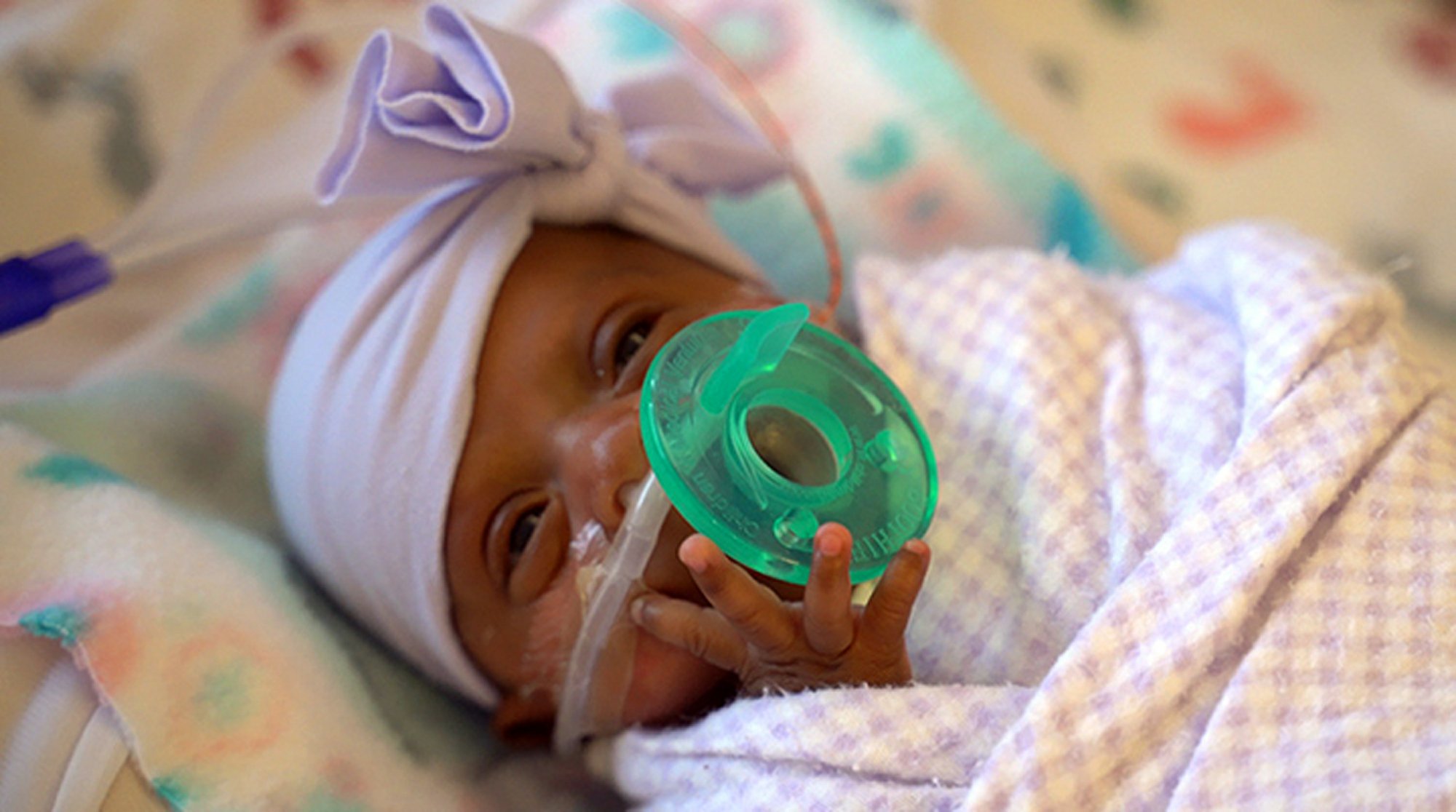 Girl born at 245 grams survives and discharged as healthy baby